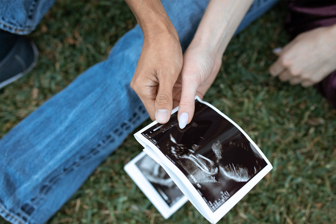 三代試管嬰兒能篩查多少種疾??？試管嬰兒基因篩查125種異常