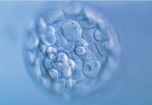 胚胎狀況 胚胎狀況