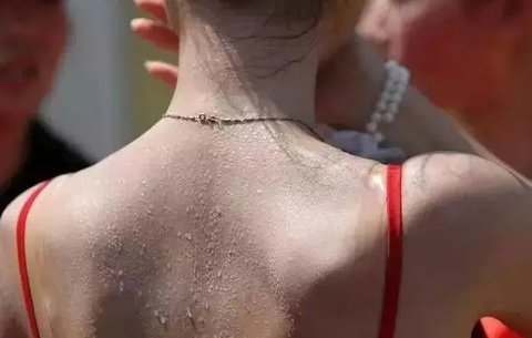 夏天出汗對(duì)身體有好處嗎？夏天出汗的十大驚人好處