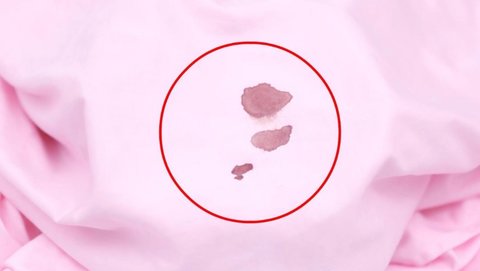 怎樣去除血漬比較干凈？去除血漬的小妙招