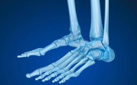 骨折好轉(zhuǎn)的跡象有哪些？骨折好轉(zhuǎn)的四個(gè)跡象