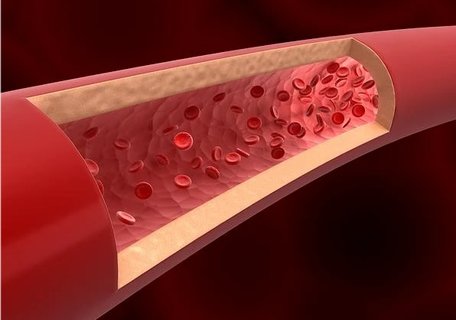 雙側(cè)輸卵管堵塞能自愈嗎？雙側(cè)輸卵管堵塞還能懷孕嗎？