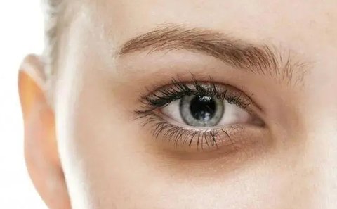 黑眼圈很重怎么去除？去除黑眼圈眼袋的小妙招