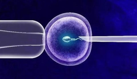 人工授精和試管哪個成功率高？人工授精和試管如何選擇？