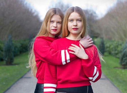 同卵雙胎和異卵雙胎哪種比較常見？同卵雙胎和異卵雙胎的區(qū)別