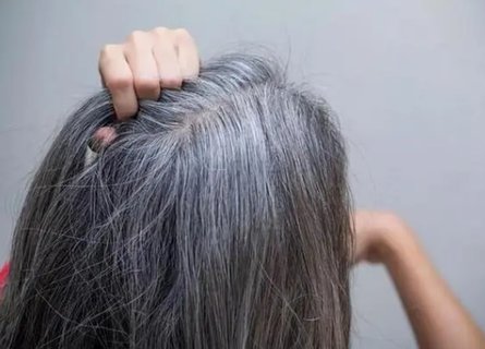 6類人容易提前長白發(fā)！探索原因與預(yù)防策略