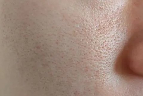 教你9種縮小毛孔方法：打造細膩肌膚的秘訣