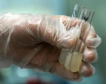 高質(zhì)量精子是什么樣的？揭秘生育關(guān)鍵因素