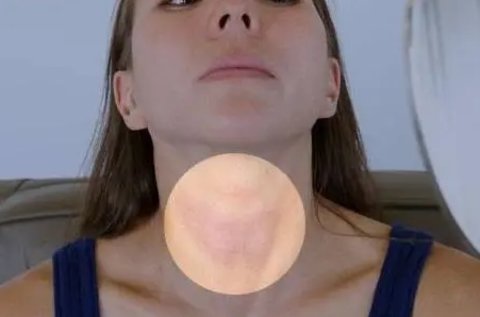 天天感覺(jué)疲勞與甲狀腺有關(guān)嗎？建議查一下甲狀腺