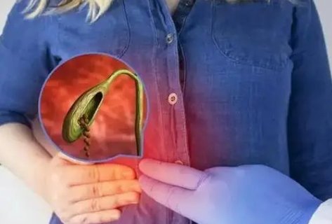 女人切除膽囊后是不是老得快？女人切除膽囊對身體的影響