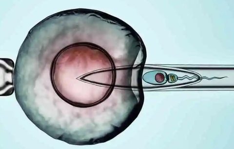 最好的試管嬰兒是第幾代？代際差異與選擇指南