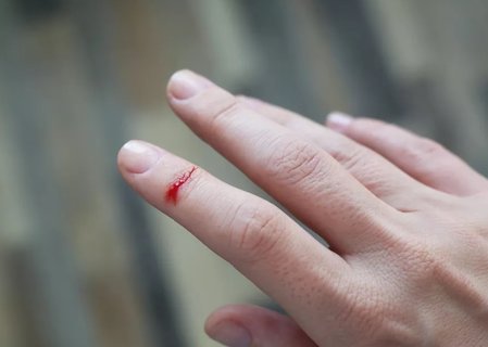 破傷風(fēng)早期有哪些癥狀？破傷風(fēng)早期的6個征兆