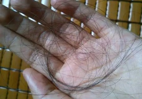 掉頭發(fā)的主要原因有哪些？掉頭發(fā)其實就2個原因