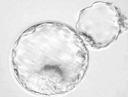 輔助孵化 輔助孵化