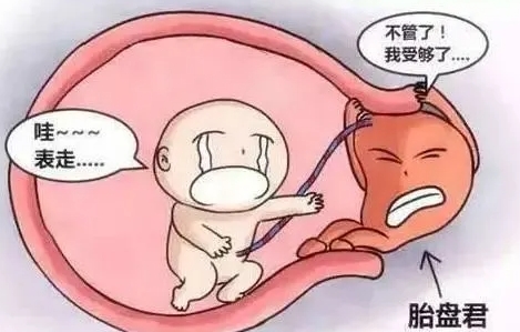 胎盤早剝是什么原因造成的？胎盤早剝的原因和癥狀