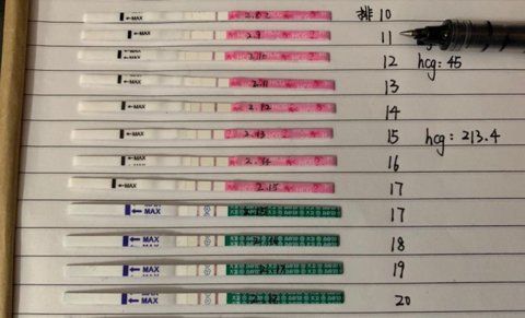 打HCG后12小時(shí)與48小時(shí)試紙檢測的區(qū)別