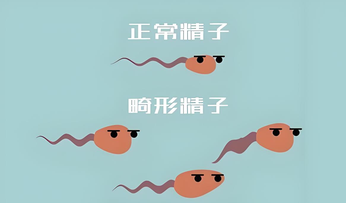 畸精癥可以做試管嬰兒嗎,畸精癥做人工授精還是試管