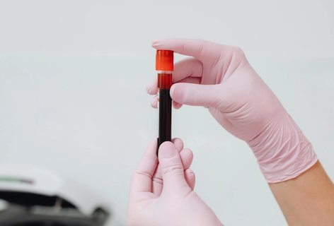 三代試管 10 萬元能成功嗎？最新三代試管費(fèi)用分析