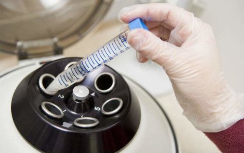 試管嬰兒 試管嬰兒