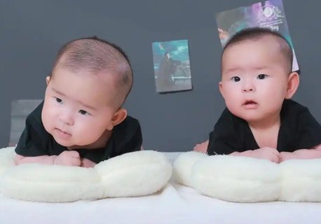 減胎風險大還是懷雙胎風險大？風險對比與選擇