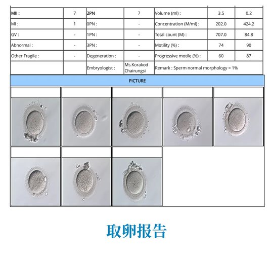 取卵報告
